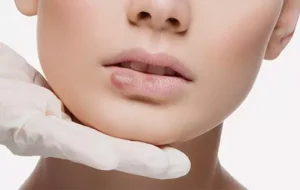  گلوله شدن ژل لب