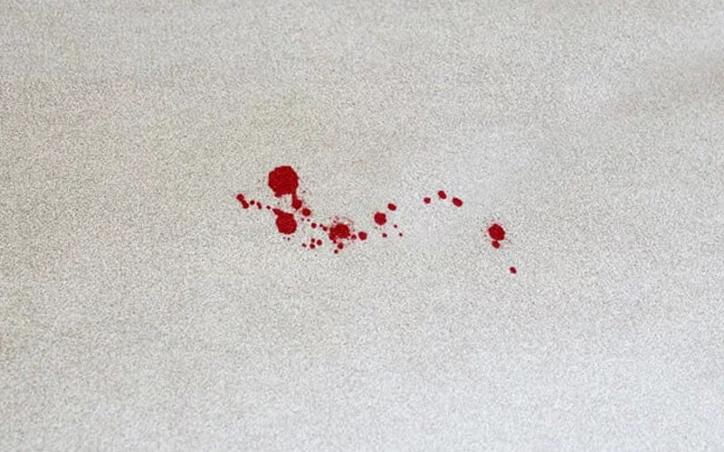 روش پاک کردن لکه خون از فرش